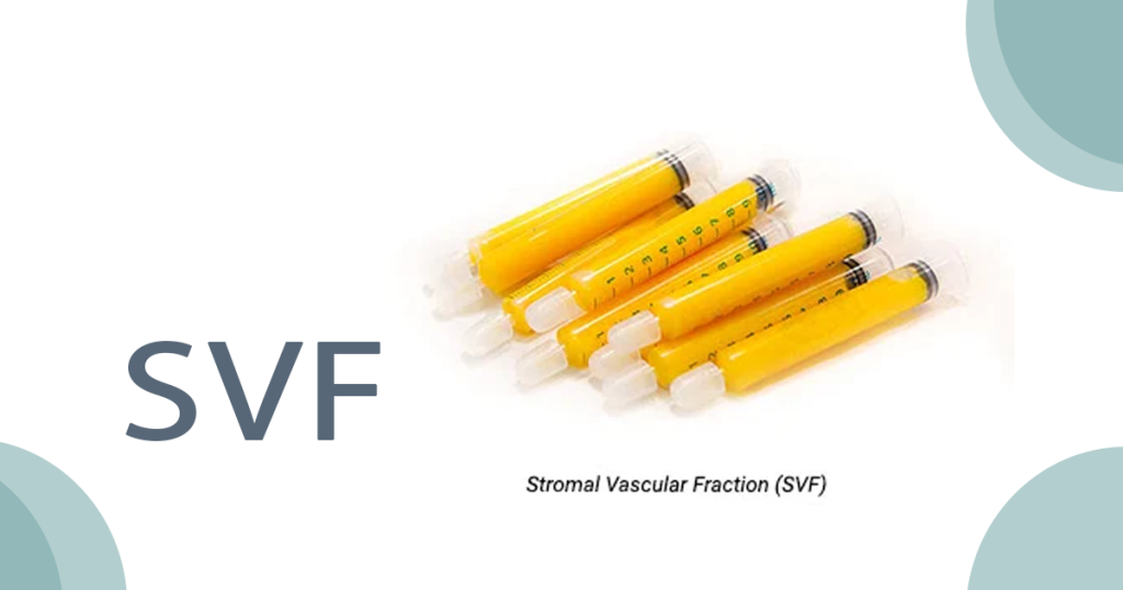 SVF