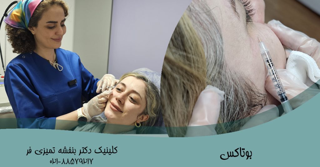 بوتاکس