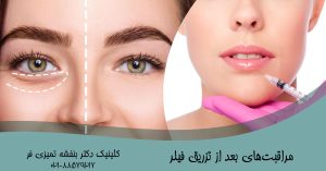 مراقبت‌های بعد از تزریق فیلر