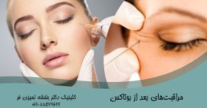 مراقبت‌های بعد از بوتاکس