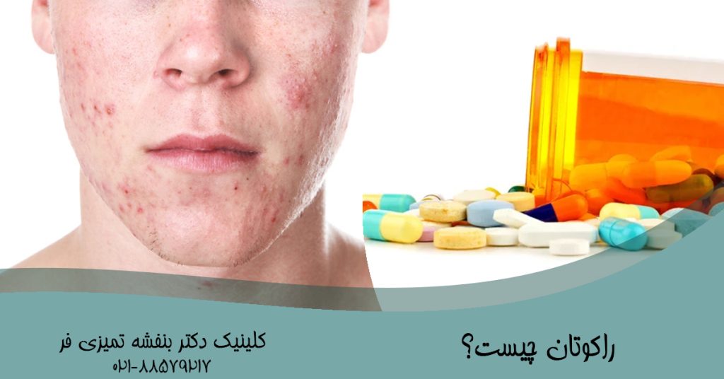  راکوتان چیست؟