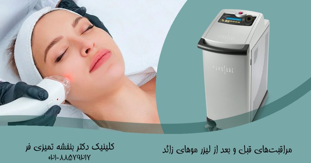 مراقبت‌های قبل و بعد از لیزر موهای زائد