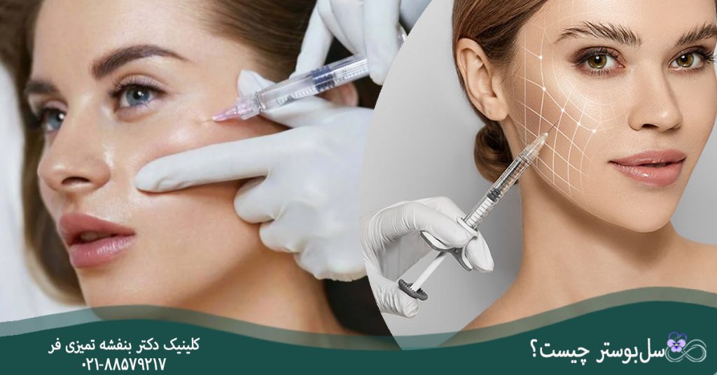 سل‌بوستر چیست؟