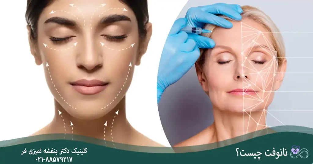 نانوفت چیست؟