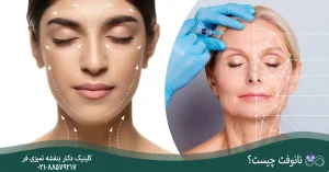 نانوفت چیست؟