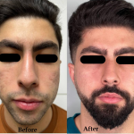 پکیج اسکار