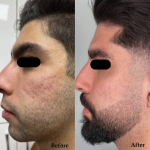 پکیج اسکار